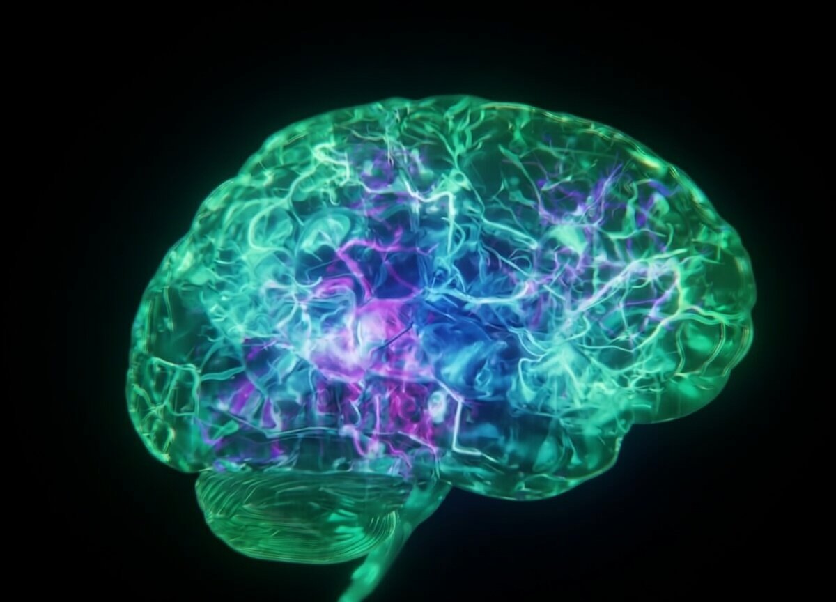 Cognition